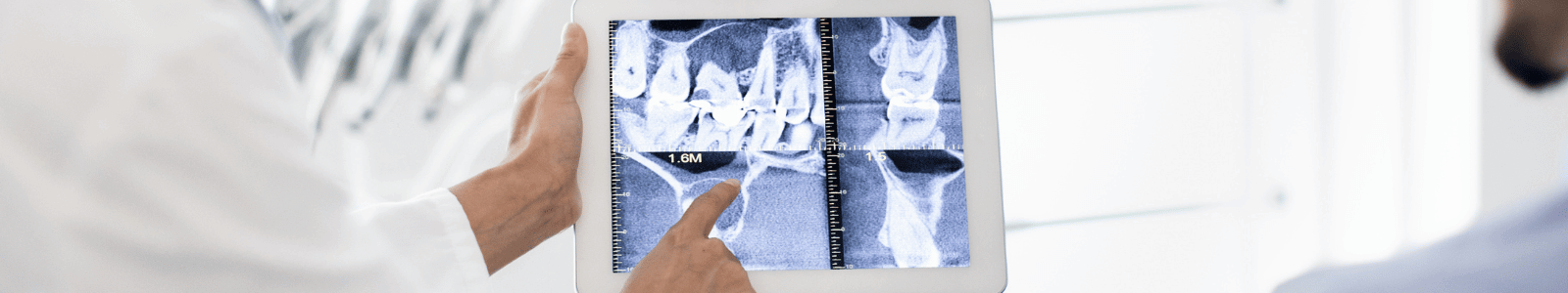 digital dental-xray