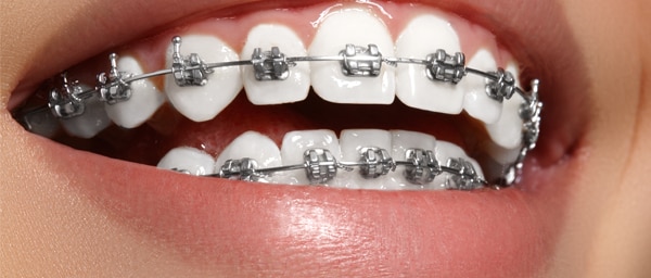 Orthodontics